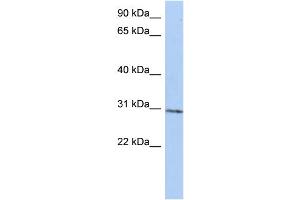 WB Suggested Anti-C14orf172 Antibody Titration:  0. (TRMT61A anticorps  (N-Term))