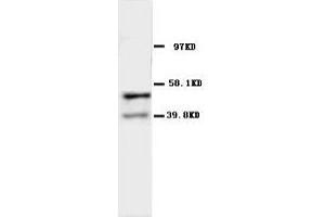 Image no. 2 for anti-Acetylcholine Receptor Subunit alpha (CHRNA1) (N-Term) antibody (ABIN1495052) (CHRNA1 anticorps  (N-Term))