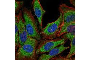 Immunofluorescence analysis of PC-2 cells using NR3C1 mouse mAb (green).