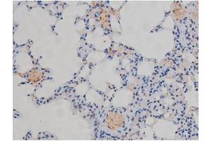 ABIN6267230 at 1/200 staining Mouse lung tissue sections by IHC-P. (IKK-alpha /IKK-beta anticorps  (pSer180, pSer181))