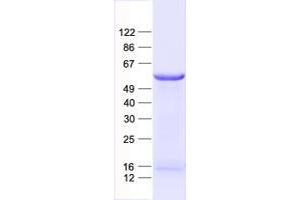 Validation with Western Blot