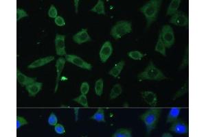 Immunofluorescence analysis of L-929 cells using EIF3D Polyclonal Antibody at dilution of 1:100. (EIF3D anticorps)
