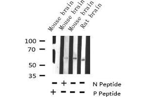 Western blot analysis of Phospho-Tyrosine Hydroxylase (Ser19) expression in various lysates (Tyrosine Hydroxylase anticorps  (pSer19))