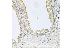 Immunohistochemistry of paraffin-embedded human prostate using ANKH antibody (ABIN6003613) at dilution of 1/100 (40x lens). (ANKH anticorps)
