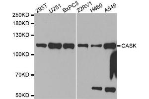 Western Blotting (WB) image for anti-Calcium/calmodulin-Dependent serine Protein Kinase (MAGUK Family) (CASK) antibody (ABIN1871447) (CASK anticorps)