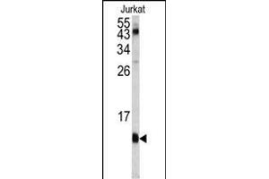 Western blot analysis of FKBP1A antibody (C-term) (ABIN1882082 and ABIN2841885) in Jurkat cell line lysates (35 μg/lane). (FKBP1A anticorps  (C-Term))