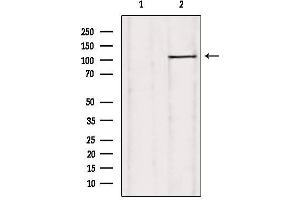 Western blot analysis of extracts from rat heart, using USP38 Antibody. (USP38 anticorps  (Internal Region))