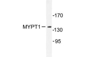 Image no. 1 for anti-Myosin Phosphatase, Target Subunit 1 (PPP1R12A) antibody (ABIN272042) (PPP1R12A anticorps)
