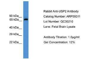 WB Suggested Anti-USP2  Antibody Titration: 0. (USP2 anticorps  (Middle Region))