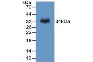 Detection of Recombinant F13A1, Rat using Polyclonal Antibody to Coagulation Factor XIII A1 Polypeptide (F13A1) (F13A1 anticorps  (AA 140-377))