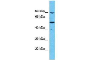 Western Blotting (WB) image for anti-Meiosis Specific with OB Domains (MEIOB) (C-Term) antibody (ABIN2786254) (MEIOB anticorps  (C-Term))