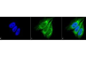 Immunocytochemistry/Immunofluorescence analysis using Rabbit Anti-KDEL Polyclonal Antibody (ABIN863187 and ABIN863188). (KDEL anticorps)