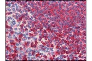 Immunohistochemistry (IHC) image for anti-Glucose-6-Phosphate Dehydrogenase (G6PD) (AA 35-506) antibody (ABIN400862)