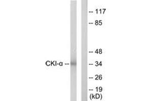 Western blot analysis of extracts from HeLa cells, using CKI-alpha Antibody. (CSNK1A1 anticorps  (AA 126-175))