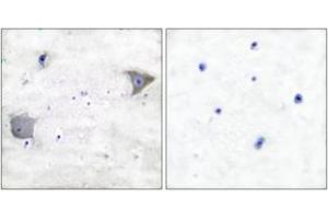 Immunohistochemistry analysis of paraffin-embedded human brain tissue, using PDGFR alpha Antibody.