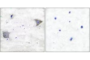 Immunohistochemistry analysis of paraffin-embedded human brain tissue, using PDGFR alpha Antibody. (PDGFRA anticorps  (AA 1031-1080))