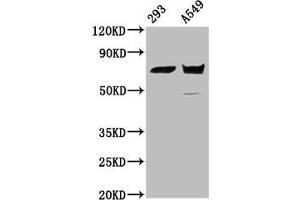 Western Blot Positive WB detected in: 293 whole cell lysate, A549 whole cell lysate All lanes: PLS1 antibody at 5.
