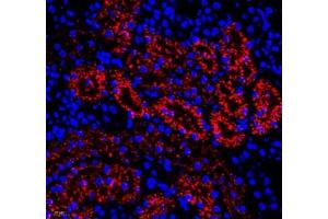 Immunofluorescence of paraffin embedded rat kidney using RBP (ABIN7075409) at dilution of 1: 650 (400x lens)