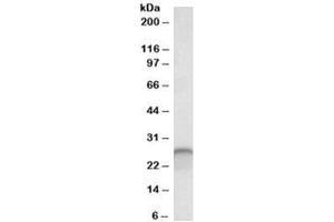Western blot testing of human cerebellum lysate with Calbindin 1 antibody at 0. (CALB1 anticorps)