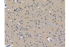 ABIN8065834 1/100 staining rat brain tissue by IHC-P.
