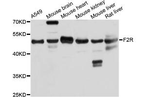Western blot analysis of extracts of various cell lines, using F2R antibody (ABIN5974987) at 1/1000 dilution. (PAR1 anticorps)