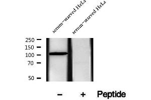 anti-Eukaryotic Elongation Factor-2 Kinase (EEF2K) (pSer366) antibody