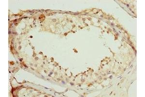 Immunohistochemistry of paraffin-embedded human testis tissue using ABIN7168517 at dilution of 1:100 (SCAPER anticorps  (AA 1109-1400))
