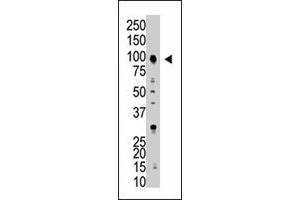The USP5 polyclonal antibody  is used in Western blot to detect USP5 in HL-60 cell lysate . (USP5 anticorps  (AA 59-90))