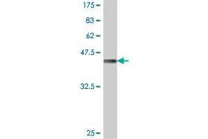 Western Blot detection against Immunogen (38. (CTHRC1 anticorps  (AA 32-141))