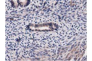 Image no. 9 for anti-Acyl-CoA Thioesterase 12 (ACOT12) antibody (ABIN1496414) (ACOT12 anticorps)