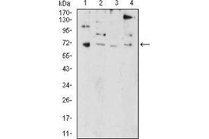 Western Blotting (WB) image for anti-PR Domain Containing 5 (PRDM5) (AA 1-100) antibody (ABIN5874500) (PRDM5 anticorps  (AA 1-100))