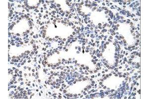 Image no. 1 for anti-Cysteinyl-tRNA Synthetase (CARS) (AA 661-710) antibody (ABIN6736226)