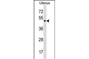 PLA2G3 Antibody (C-term) (ABIN1537347 and ABIN2850277) western blot analysis in Uterus tissue lysates (35 μg/lane). (PLA2G3 anticorps  (C-Term))
