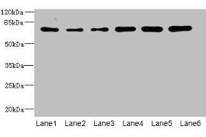 Western blot All lanes: ZNF555 antibody at 2 μg/mL Lane 1: HepG2 whole cell lysate Lane 2: 293T whole cell lysate Lane 3: Hela whole cell lysate Lane 4: Jurkat whole cell lysate Lane 5: Mouse liver tissue Lane 6: HL60 whole cell lysate Secondary Goat polyclonal to rabbit IgG at 1/10000 dilution Predicted band size: 74, 64, 73 kDa Observed band size: 74 kDa (ZNF555 anticorps  (AA 1-200))