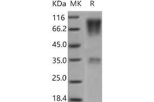 Western Blotting (WB) image for CD164 (CD164) protein (Fc Tag) (ABIN7321109) (CD164 Protein (CD164) (Fc Tag))