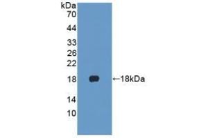 Detection of Recombinant KRT1, Human using Polyclonal Antibody to Cytokeratin 1 (CK1) (Cytokeratin 1 anticorps  (AA 487-644))