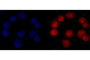 IF analysis of MSH2 using anti-MSH2 antibody (ABIN7601369).