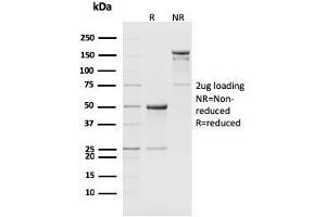 SDS-PAGE Analysis Purified CD8b Rat Monoclonal Antibody (H35-17. (CD8B anticorps)