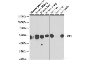 Western blot analysis of extracts of various cell lines using IHH Polyclonal Antibody at dilution of 1:1000. (Indian Hedgehog anticorps)