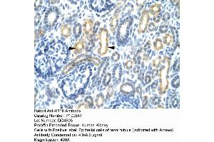 Human kidney (IRF8 anticorps  (N-Term))
