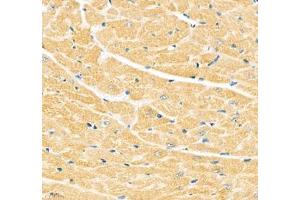 Immunohistochemistry of paraffin embedded mouse heart using Junctophilin2 (ABIN7074393) at dilution of 1: 600 (400x lens)