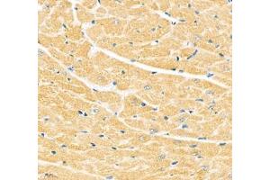 Immunohistochemistry of paraffin embedded mouse heart using Junctophilin2 (ABIN7074393) at dilution of 1: 600 (400x lens) (Junctophilin 2 anticorps)