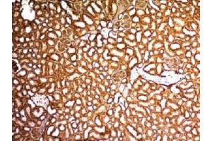 IHC testing of FFPE mouse kidney with WT1 antibody. (WT1 anticorps)