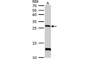 WB Image HPRT antibody detects HPRT1 protein by Western blot analysis. (HPRT1 anticorps)