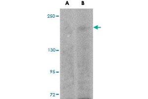 Western blot analysis of SIPA1L1 in rat brain tissue lysate with SIPA1L1 polyclonal antibody  at (A) 0. (SIPA1L1 anticorps  (N-Term))