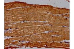 IHC image of ABIN7142671 diluted at 1:30 and staining in paraffin-embedded human skeletal muscle tissue performed on a Leica BondTM system.