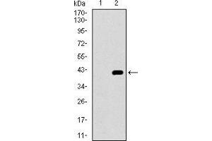 Western blot analysis using ITGA2B mAb against HEK293 (1) and ITGA2B (AA: 45-149)-hIgGFc transfected HEK293 (2) cell lysate.