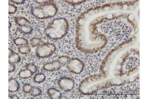 Immunoperoxidase of monoclonal antibody to SP1 on formalin-fixed paraffin-embedded human small Intestine. (SP1 anticorps  (AA 89-198))