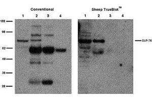 Sheep TrueBlot® IP / Western Blot: Jurkat cell lysate (500 µg) was incubated with 2 µg of sheep anti-SLP76 and immunoprecipitated using Protein G. (Mouton TrueBlot® Anti-Mouton IgG HRP)