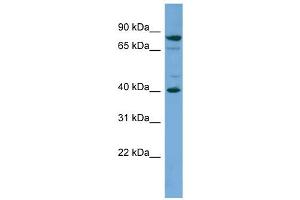 WB Suggested Anti-PNMA2 Antibody Titration: 0. (PNMA2 anticorps  (Middle Region))